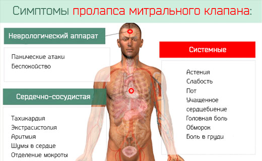 атеросклероз