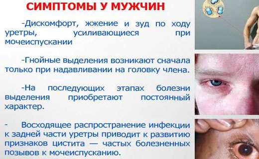 проявление гонореи