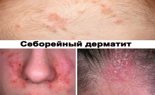 пенсия