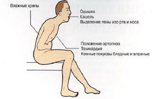 кашель