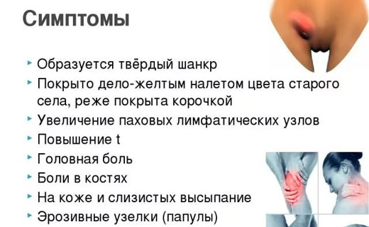 сифилис лечение