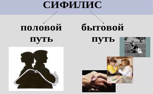 сифилис лечение
