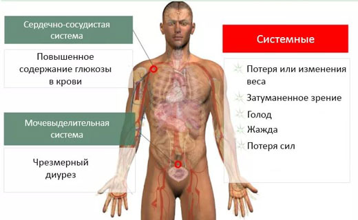 первые симптомы диабета