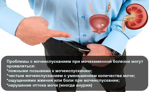 почки