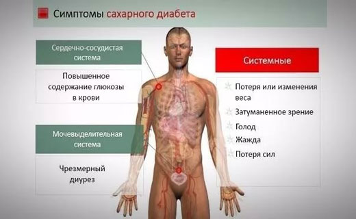 первые симптомы диабета