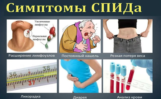спид симптоматика