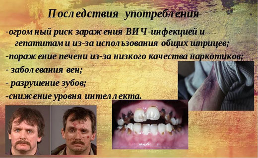 спид симптоматика