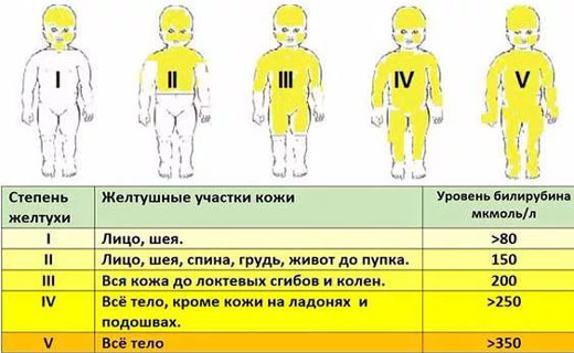 желтуха