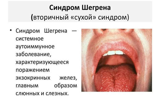 причины потери слуха