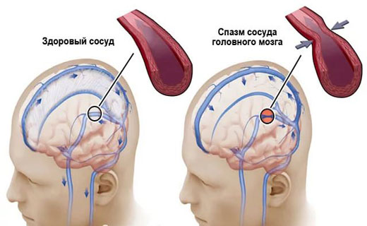 гловной мозг