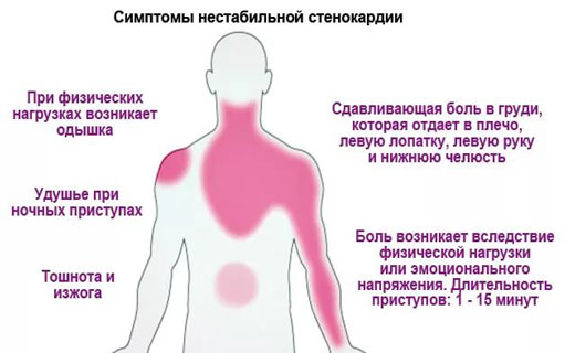 гловной мозг