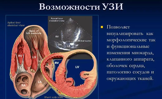 гловной мозг