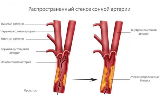 гловной мозг