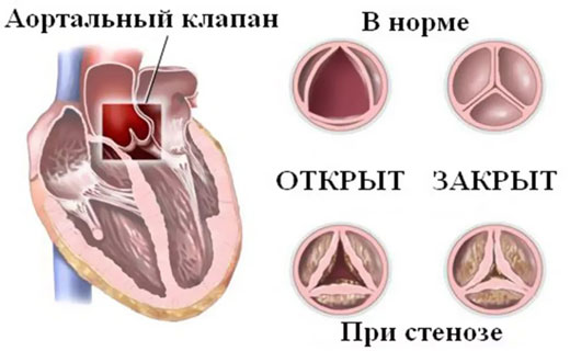 гловной мозг