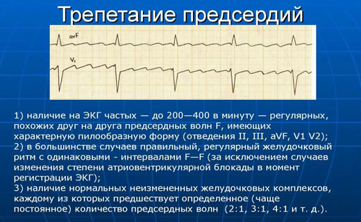 атеросклероз