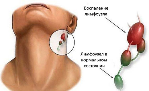пенсия