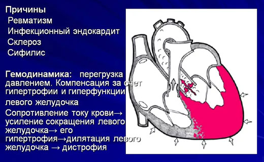 гловной мозг