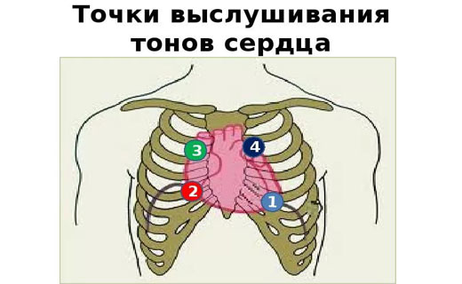 дистония