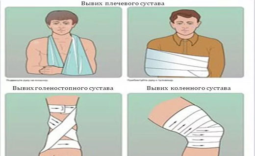 симптомы вывиха