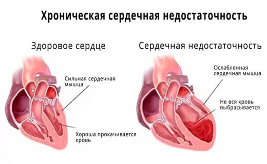 недостаточность