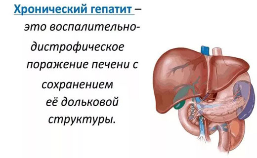 желтуха