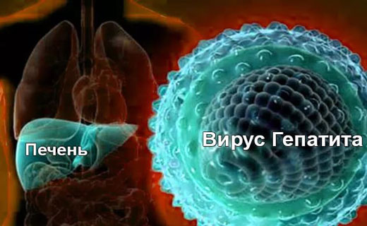 желтуха