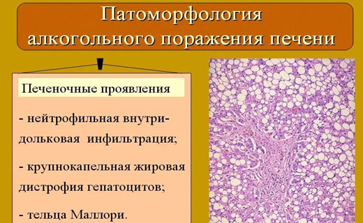 желтуха