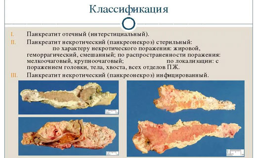 желтуха