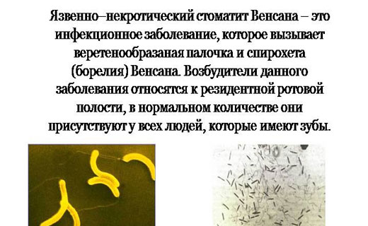 как распознать язвенный стоматит