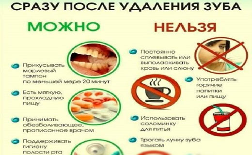 наркоз