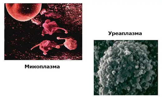уераплазмоз