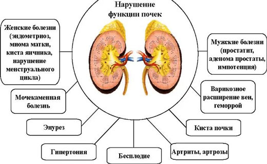 почки