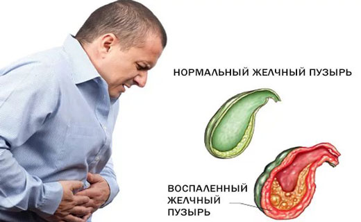 острый халистицид