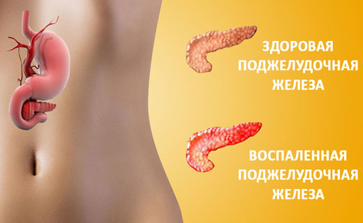 болит поджелудочная