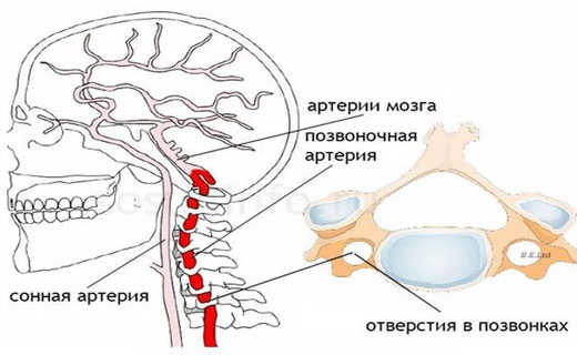 пережата артерия