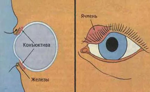 причины боли глаза