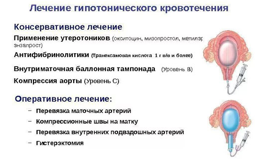 лечение гипотонического кровотечения
