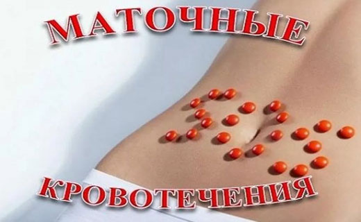 кровотечение маточное