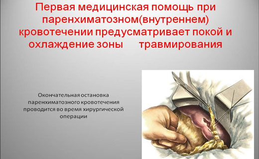 паренхиматозное кровотечение