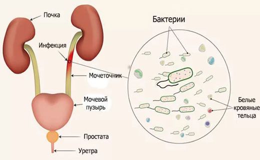лейкоциты в почках