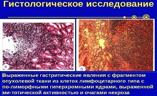 гистология
