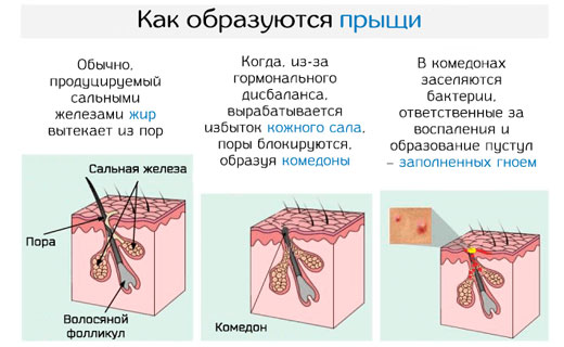 отечность сальных желез