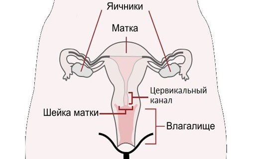 полип цервикального канала