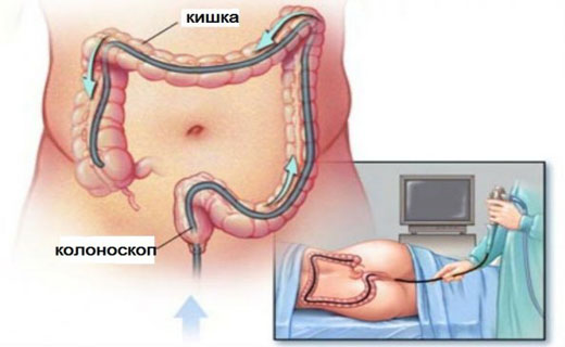 эндоскопия