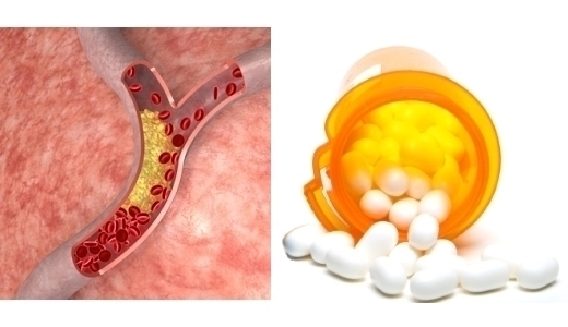 инструкция по применению simvastatin
