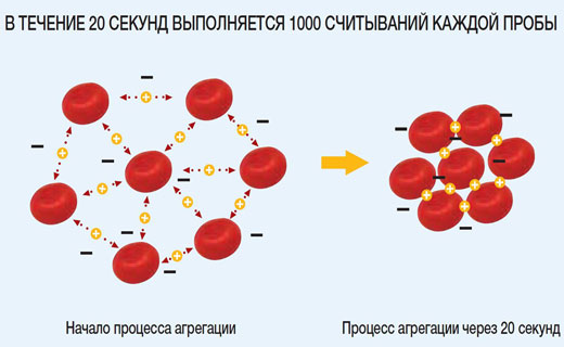 соэ