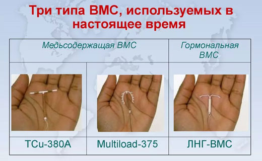 типы спиралей