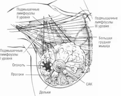Где под мышками находится лимфоузел Где под мышками находится лимфоузел