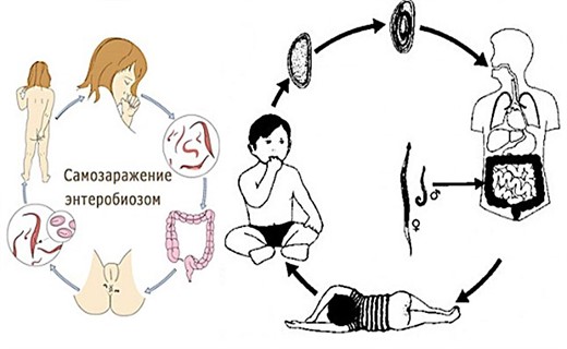 Как сдавать энтеробиоз ребенку