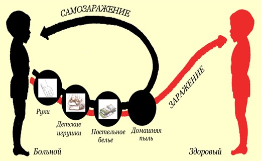 Какие бывают глисты фото